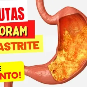 5 FRUTAS que PIORAM A GASTRITE, REFLUXO, AZIA e QUEIMAÇÃO - Fique Atento!