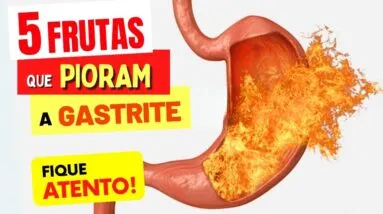 5 FRUTAS que PIORAM A GASTRITE, REFLUXO, AZIA e QUEIMAÇÃO - Fique Atento!