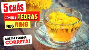 5 Melhores CHÁS contra PEDRA NOS RINS - Benefícios, Como Preparar e Como Tomar
