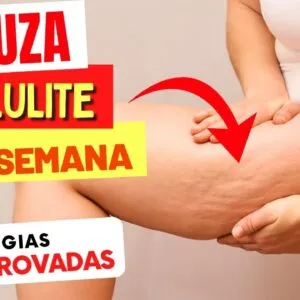 Como DIMINUIR A CELULITE em 1 SEMANA - Estratégias Comprovadas para Resultados Rápidos
