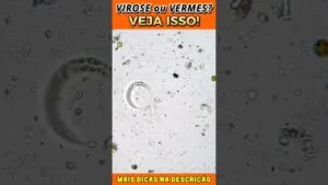Virose ou Vermes? Veja Isso!