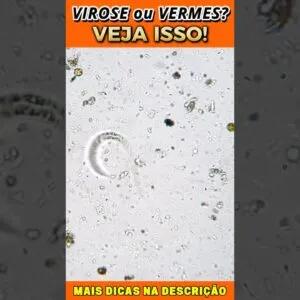 Virose ou Vermes? Veja Isso!