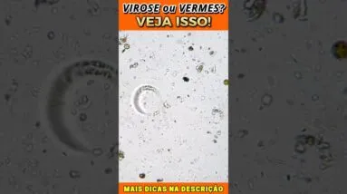 Virose ou Vermes? Veja Isso!