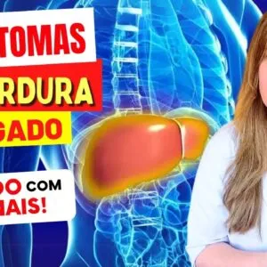 10 SINAIS DE ALERTA para GORDURA NO FÍGADO - Cuidado com estes SINTOMAS!