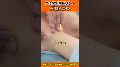 ⚠️ Sinal nos PÉS que alerta problemas no FÍGADO! Você tem?