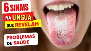 Sua LÍNGUA Está ASSIM? O Que Isso Diz Sobre Sua Saúde - 6 SINAIS ESTRANHOS que Você NÃO DEVE IGNORAR