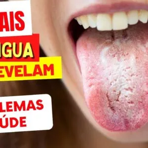 Sua LÍNGUA Está ASSIM? O Que Isso Diz Sobre Sua Saúde - 6 SINAIS ESTRANHOS que Você NÃO DEVE IGNORAR
