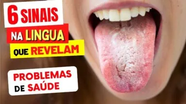 Sua LÍNGUA Está ASSIM? O Que Isso Diz Sobre Sua Saúde - 6 SINAIS ESTRANHOS que Você NÃO DEVE IGNORAR
