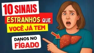 10 SINAIS ESTRANHOS que você já tem DANOS NO FÍGADO (e o que fazer!)