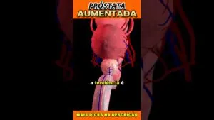 🧬 Próstata Aumentada: Zinco Funciona? Veja o Que Diz a Ciência