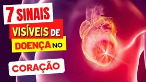 Seu Corpo Está Avisando: 7 SINTOMAS de DOENÇA CARDÍACA que Aparecem na Pele, Rosto e Unhas!