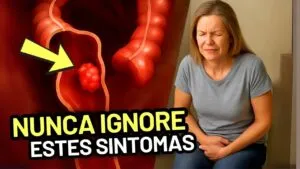 CÂNCER NO INTESTINO está AUMENTANDO - 6 Sintomas que NUNCA Devem Ser IGNORADOS