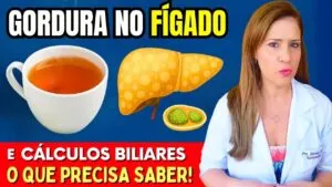Chás Quebram GORDURA no FÍGADO e PEDRAS na VESÍCULA? Descubra a Verdade!