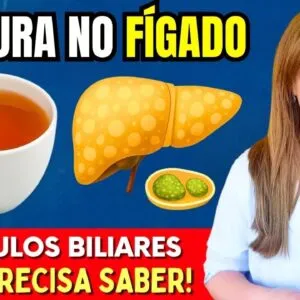 Chás Quebram GORDURA no FÍGADO e PEDRAS na VESÍCULA? Descubra a Verdade!