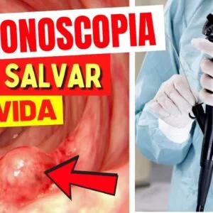 Exame que PREVINE DOENÇAS GRAVES Antes dos Sintomas e Salva Vidas! A Importante COLONOSCOPIA