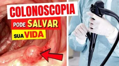 Exame que PREVINE DOENÇAS GRAVES Antes dos Sintomas e Salva Vidas! A Importante COLONOSCOPIA