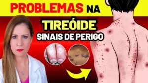 9 SINAIS no Seu Corpo que Sua TIREOIDE Dá Antes de Morrer + 4 Fatos Científicos Que Ninguém Fala