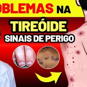 9 SINAIS no Seu Corpo que Sua TIREOIDE Dá Antes de Morrer + 4 Fatos Científicos Que Ninguém Fala