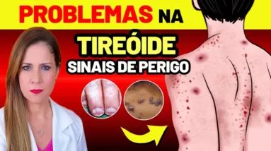 9 SINAIS no Seu Corpo que Sua TIREOIDE Dá Antes de Morrer + 4 Fatos Científicos Que Ninguém Fala