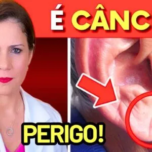Se Você TEM ALGUM destes 7 SINAIS, Pode Ser CÂNCER ou DOENÇA GRAVE! Vá ao MÉDICO IMEDIATAMENTE