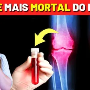 NUNCA FAÇA ESTE EXAME: 7 Exames Médicos Comuns e Perigosos (Evite a Todo Custo)