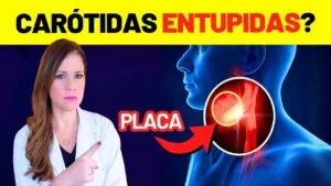 PLACA NA CARÓTIDA: 7 PASSOS URGENTES para LIMPAR SUAS ARTÉRIAS e EVITAR UM DERRAME (AVC)