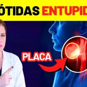 PLACA NA CARÓTIDA: 7 PASSOS URGENTES para LIMPAR SUAS ARTÉRIAS e EVITAR UM DERRAME (AVC)