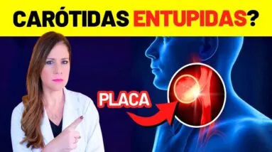 PLACA NA CARÓTIDA: 7 PASSOS URGENTES para LIMPAR SUAS ARTÉRIAS e EVITAR UM DERRAME (AVC)