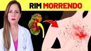 9 SINAIS no seu Corpo que seu RIM Dá Antes de Morrer + 7 Dicas para Salvar seus RINS AGORA!
