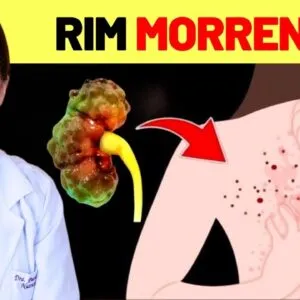 9 SINAIS no seu Corpo que seu RIM Dá Antes de Morrer + 7 Dicas para Salvar seus RINS AGORA!