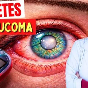 ALERTA DIABÉTICOS E GLAUCOMA: Alimentos ARRISCADOS e Alimentos IMPORTANTES para a SAÚDE DOS OLHOS!