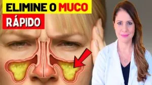 ISSO ELIMINA o MUCO NA GARGANTA RÁPIDO - A CAUSA REAL do Pigarro (Catarro, Secreção,..) é ESTA!