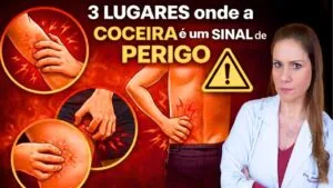 3 LUGARES onde a COCEIRA é um SINAL de PERIGO – Não Ignore! O Que Fazer?