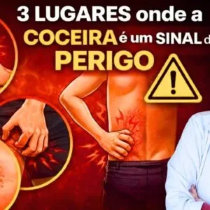 3 LUGARES onde a COCEIRA é um SINAL de PERIGO – Não Ignore! O Que Fazer?