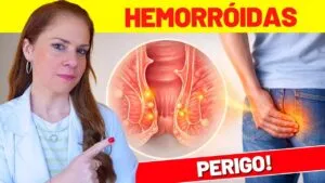 Dor, Coceira Anal ou Sangramento? Sinais de ALERTA de HEMORRÓIDAS
