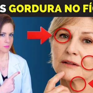 Gordura no Fígado: SINAIS VISÍVEIS no Corpo que Você NÃO DEVE IGNORAR!