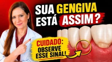 Gengiva Retraiu? CUIDADO! É um SINAL MAIS IMPORTANTE do que IMAGINA!
