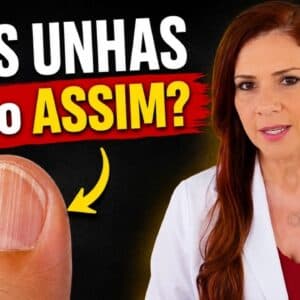 CUIDADO! UNHAS ASSIM? RISCO PARA A SAÚDE!