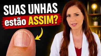 CUIDADO! UNHAS ASSIM? RISCO PARA A SAÚDE!