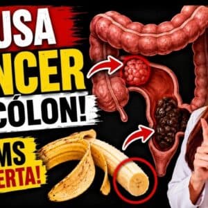 O Pior VENENO que Pode Causar CÂNCER DE CÓLON em Silêncio! (ALERTA da OMS) – Entenda o Risco!
