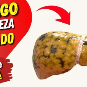 O PERIGO da LIMPEZA OU DESINTOXICAÇÃO do FÍGADO!