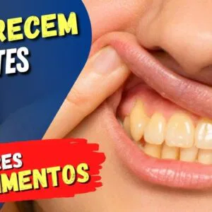 10 ALIMENTOS que ESCURECEM A COR DOS DENTES e Como EVITAR