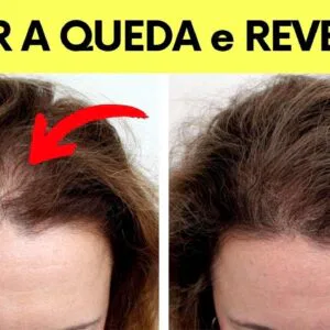 QUEDA DE CABELO EM MULHERES - A forma mais rápida de PARAR e REVERTER