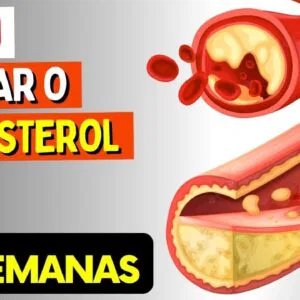 Como BAIXAR O COLESTEROL em 2 SEMANAS - Naturalmente! (Sem Remédios)
