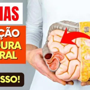 30 DIAS para REDUÇÃO MÁXIMA da GORDURA VISCERAL - Faça assim!
