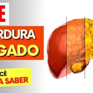 LEITE e GORDURA NO FÍGADO -  O que você PRECISA SABER!