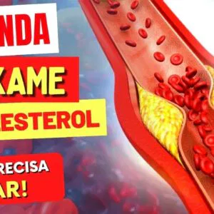 ENTENDA seu EXAME DE COLESTEROL e O QUE PRECISA MUDAR!