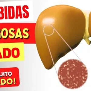 5 Bebidas PERIGOSAS para o FÍGADO [Cuidado!]