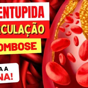 RUTINA contra VEIAS ENTUPIDAS, COÁGULOS, MÁ CIRCULAÇÃO e TROMBOSE - Veja ISSO!