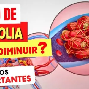 Como DIMINUIR SEU RISCO DE EMBOLIA - Cuidados IMPORTANTES